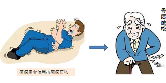 郑州军海脑病医院丨癫痫患者补钙，千万别乱来!尤其是2年以上癫痫患者，4个禁忌不能碰!