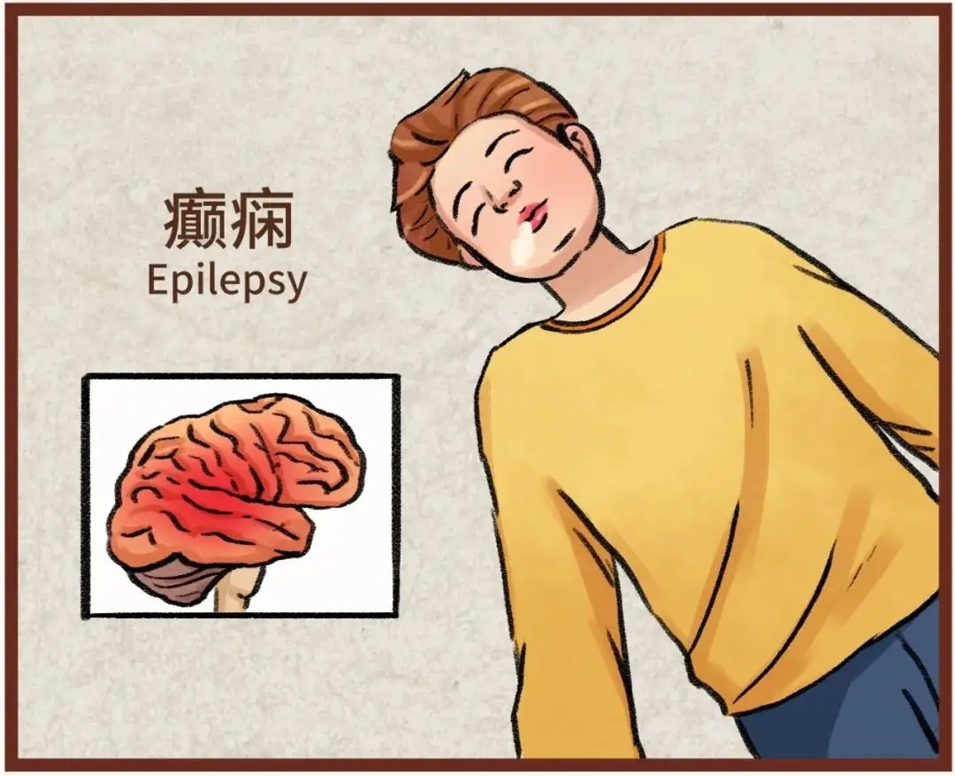 郑州军海医院好吗丨警惕!这8个“隐形诱因”，可能诱发癫痫发作